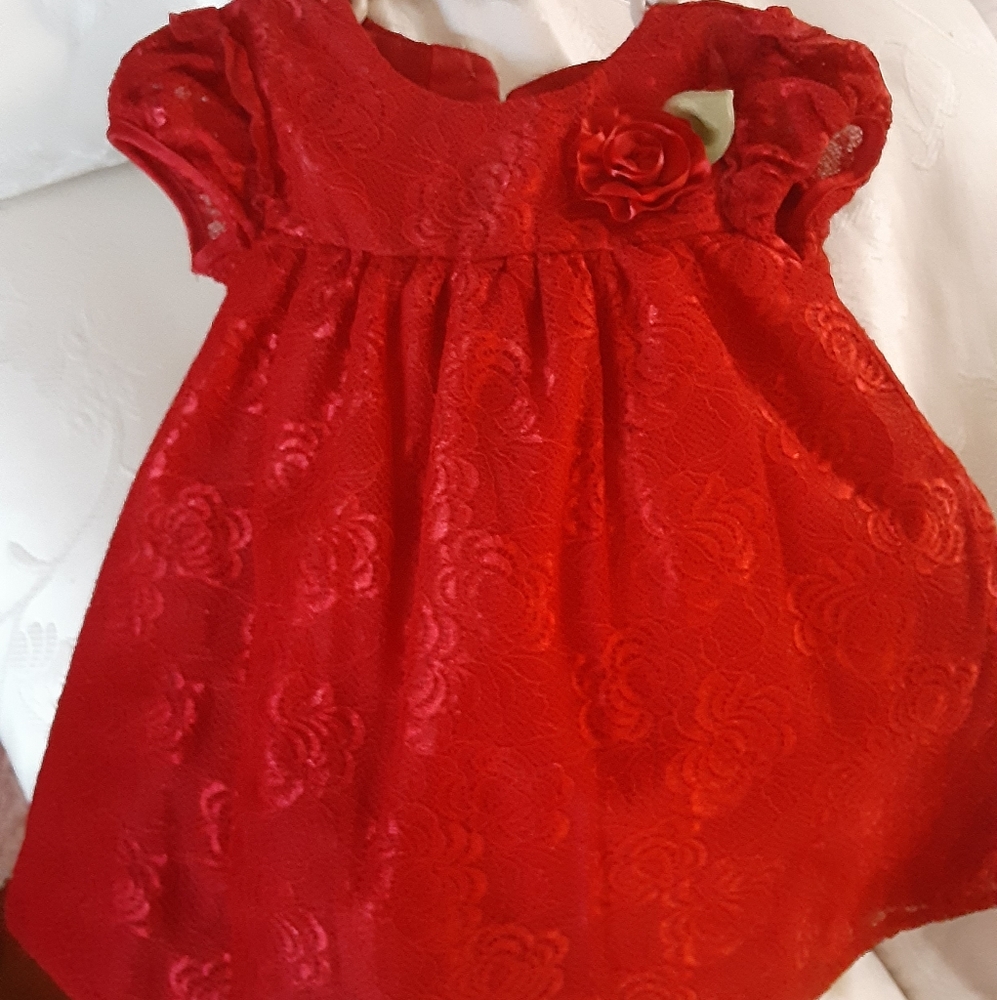 Dress baby